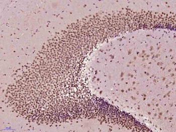 Phospho-AKT1 + AKT2 + AKT3 (Thr308+Thr309+Thr305) Rabbit Polyclonal Antibody