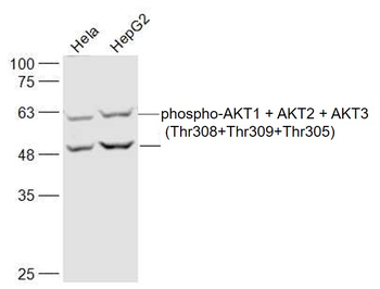 Phospho-AKT1 + AKT2 + AKT3 (Thr308+Thr309+Thr305) Rabbit Polyclonal Antibody