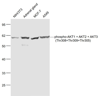 Phospho-AKT1 + AKT2 + AKT3 (Thr308+Thr309+Thr305) Rabbit Polyclonal Antibody