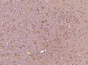 Phospho-AKT1 (Thr34) Rabbit Polyclonal Antibody