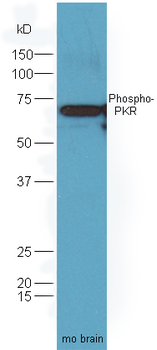 Phospho-PKR (Thr446) Rabbit Polyclonal Antibody
