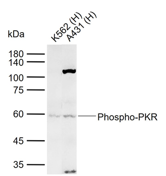 Phospho-PKR (Thr446) Rabbit Polyclonal Antibody