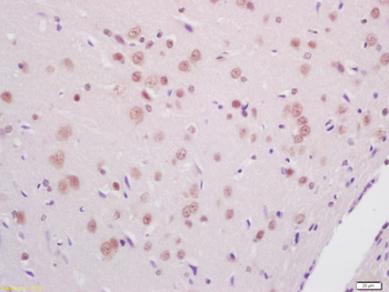 Phospho-PKR (Thr446) Rabbit Polyclonal Antibody