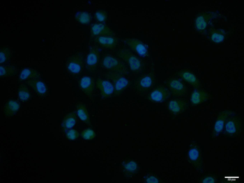 Phospho-PKR (Thr451) Rabbit Polyclonal Antibody