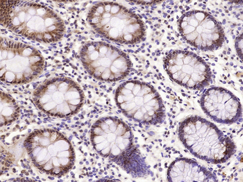 Phospho-PKR (Thr451) Rabbit Polyclonal Antibody