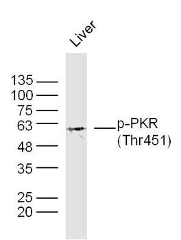 Phospho-PKR (Thr451) Rabbit Polyclonal Antibody
