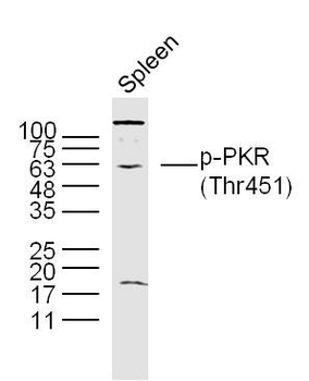 Phospho-PKR (Thr451) Rabbit Polyclonal Antibody