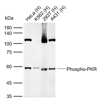 Phospho-PKR (Thr446 + Thr451) Rabbit Polyclonal Antibody