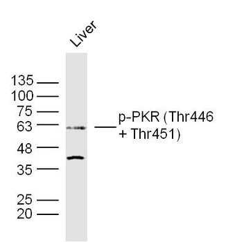 Phospho-PKR (Thr446 + Thr451) Rabbit Polyclonal Antibody