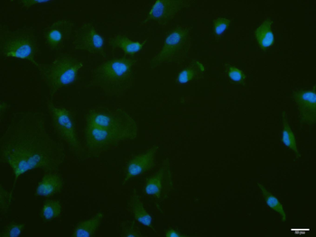 Phospho-PKR (Thr446 + Thr451) Rabbit Polyclonal Antibody