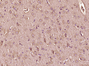 AKT3 Rabbit Polyclonal Antibody