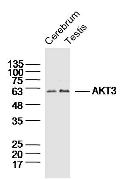 AKT3 Rabbit Polyclonal Antibody