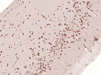 Phospho-AKT2 (Ser474) Rabbit Polyclonal Antibody