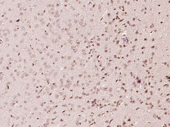Phospho-AKT2 (Ser474) Rabbit Polyclonal Antibody