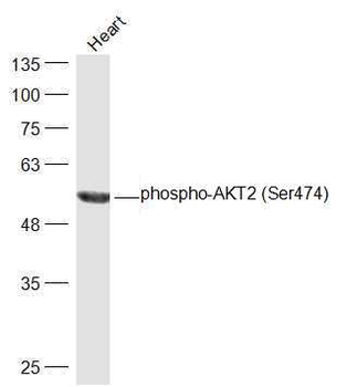 Phospho-AKT2 (Ser474) Rabbit Polyclonal Antibody