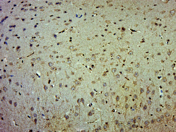 Phospho-AKT1+AKT2+AKT3 (Tyr315+316+312) Rabbit Polyclonal Antibody