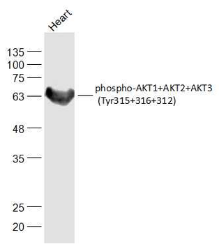Phospho-AKT1+AKT2+AKT3 (Tyr315+316+312) Rabbit Polyclonal Antibody