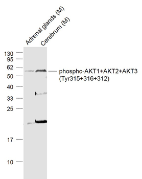 Phospho-AKT1+AKT2+AKT3 (Tyr315+316+312) Rabbit Polyclonal Antibody