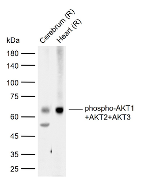 Phospho-AKT1+AKT2+AKT3 (Tyr315+316+312) Rabbit Polyclonal Antibody