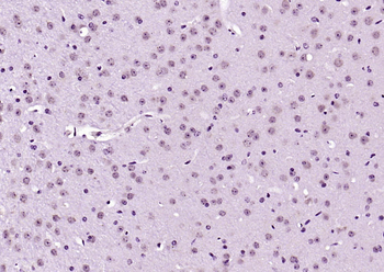 Phospho-AKT3 (Ser472) Rabbit Polyclonal Antibody