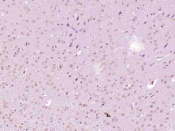 Phospho-AKT3 (Ser472) Rabbit Polyclonal Antibody