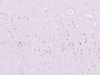 Phospho-AKT3 (Ser472) Rabbit Polyclonal Antibody