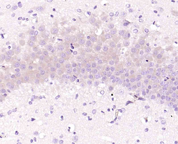 Phospho-AKT1S1 (Thr246) Rabbit Polyclonal Antibody