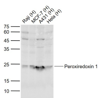 Peroxiredoxin 1 Rabbit Polyclonal Antibody