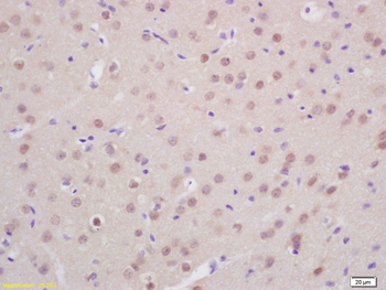 Prox1 Rabbit Polyclonal Antibody