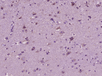 PSAP Rabbit Polyclonal Antibody