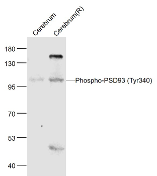 Phospho-PSD93 (Tyr340) Rabbit Polyclonal Antibody