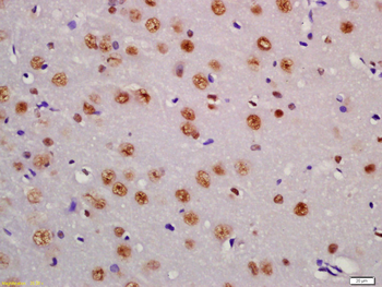 Phospho-PTEN (Ser380 + Thr382 + Thr383) Rabbit Polyclonal Antibody