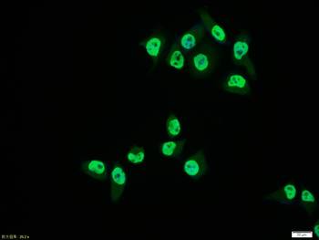 Phospho-PTEN (Ser380 + Thr382 + Thr383) Rabbit Polyclonal Antibody