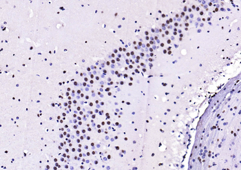 Phospho-PTEN (Ser380 + Thr382 + Thr383) Rabbit Polyclonal Antibody