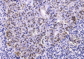 Phospho-PTEN (Ser380 + Thr382 + Thr383) Rabbit Polyclonal Antibody