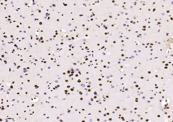 Phospho-PTEN (Ser380 + Thr382 + Thr383) Rabbit Polyclonal Antibody