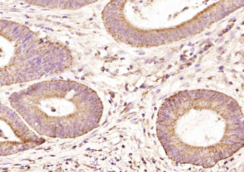 PTPMT1 Rabbit Polyclonal Antibody