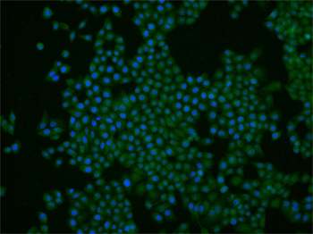 PITX3 Rabbit Polyclonal Antibody