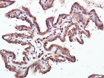 Raptor Rabbit Polyclonal Antibody