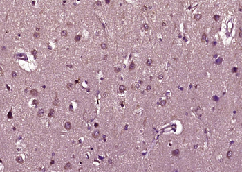 Phospho-Raptor (Ser792) Rabbit Polyclonal Antibody