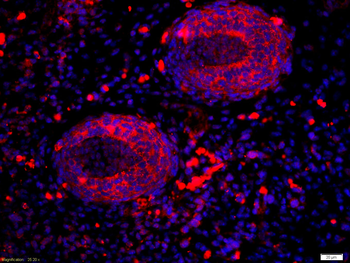 ALDH1A2 Rabbit Polyclonal Antibody