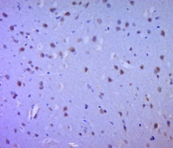 Phospho-RAF1 (Ser471) Rabbit Polyclonal Antibody