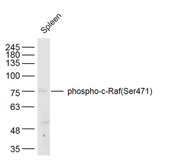 Phospho-RAF1 (Ser471) Rabbit Polyclonal Antibody