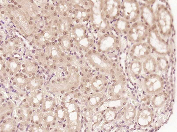 Phospho-Rb (Ser249) Rabbit Polyclonal Antibody