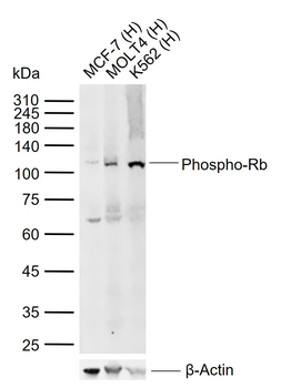Phospho-Rb (Ser608) Rabbit Polyclonal Antibody