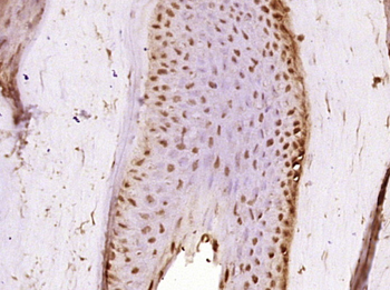 Phospho-Rb (Ser807 + Ser811) Rabbit Polyclonal Antibody