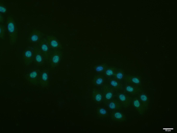 Phospho-Rb (Thr821) Rabbit Polyclonal Antibody
