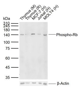 Phospho-Rb (Ser795) Rabbit Polyclonal Antibody