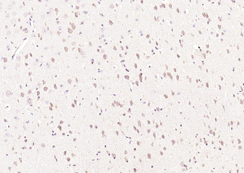 RelB Rabbit Polyclonal Antibody