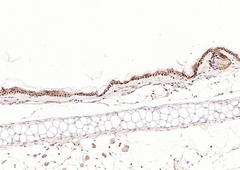 RelB Rabbit Polyclonal Antibody